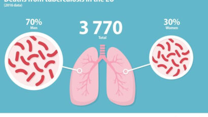 România, în topul deceselor provocate de tuberculoză